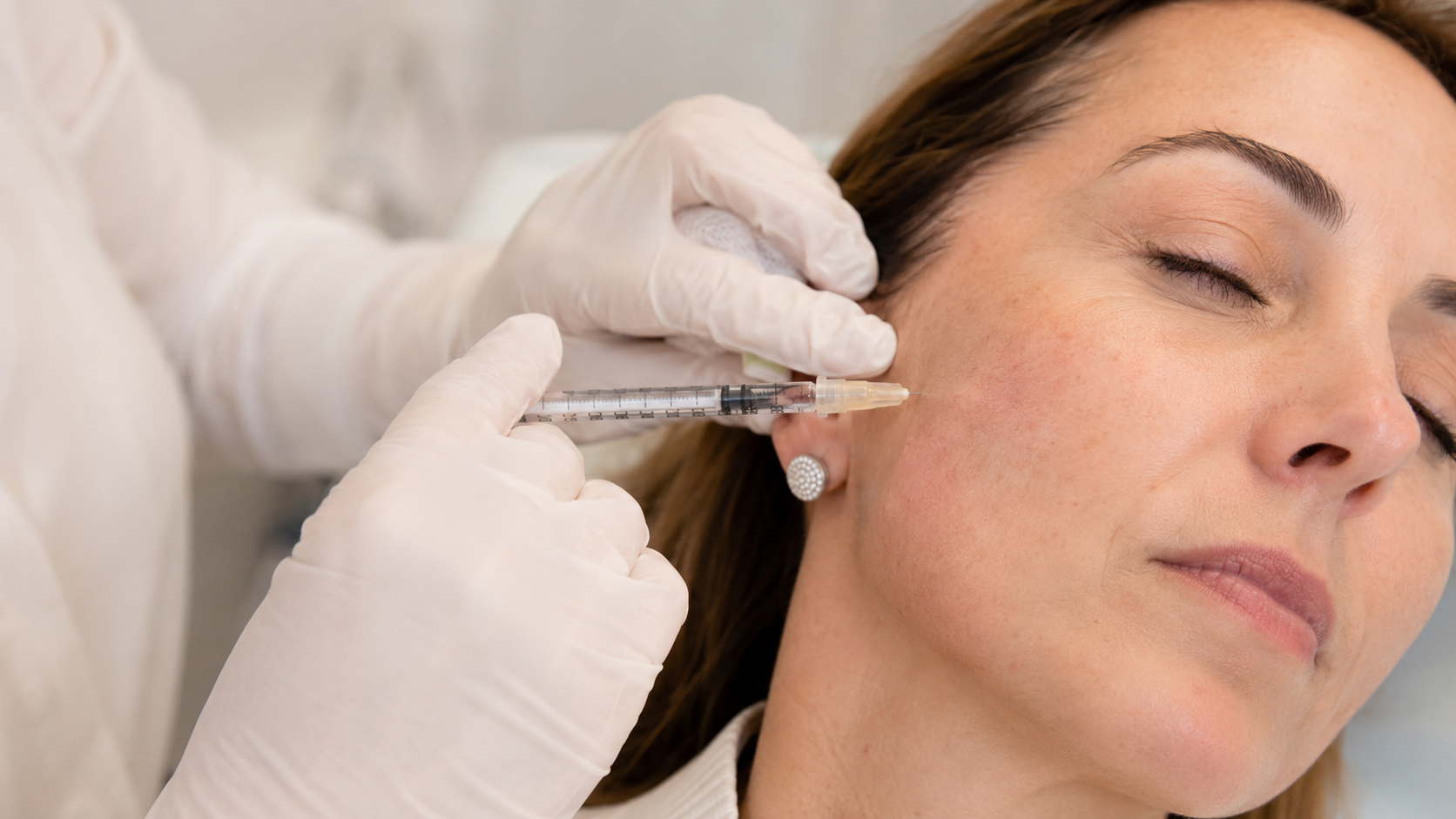 Tratamento Profhilo / Biorremodelação Facial